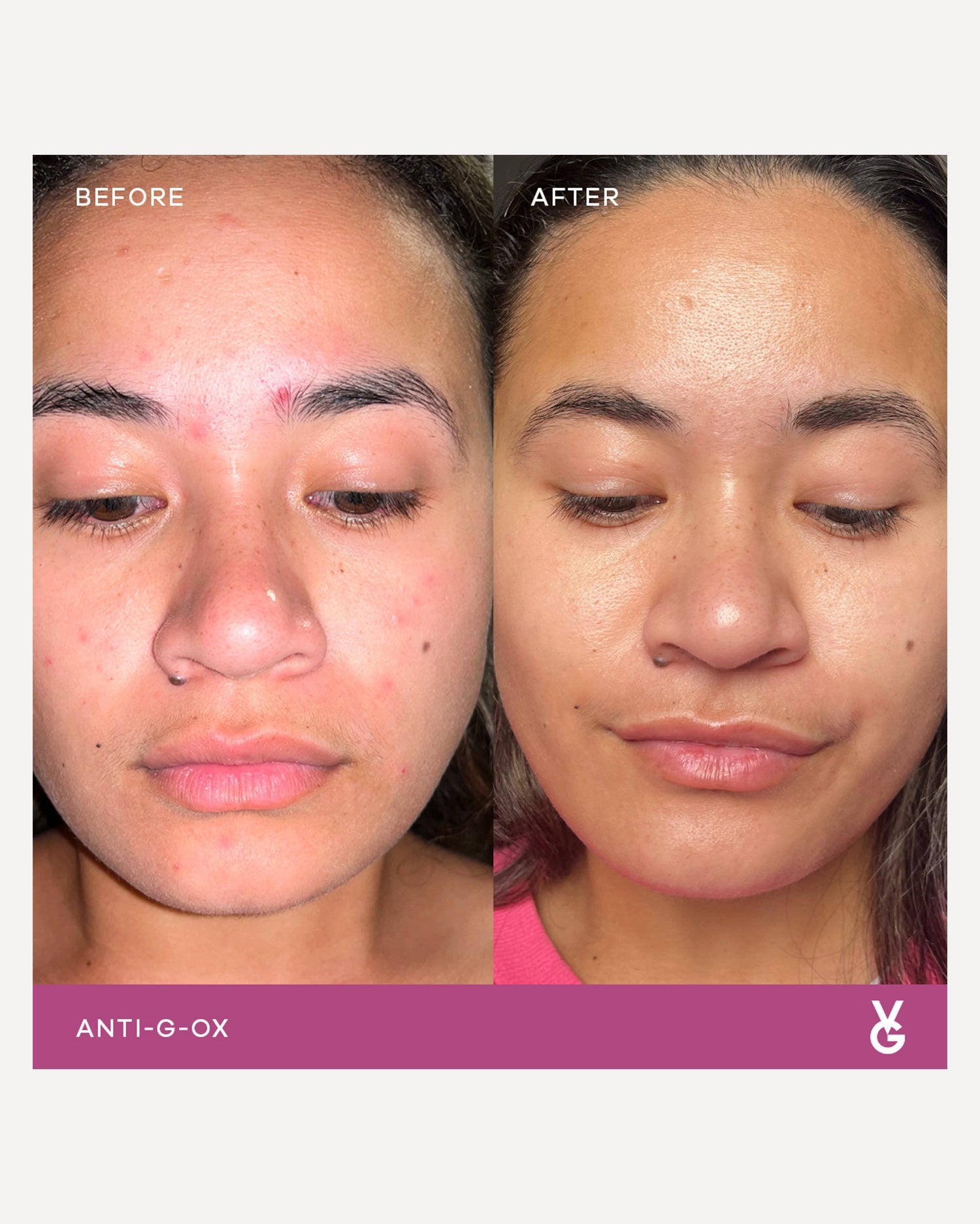 Anti-G-Ox - Mixed Trial Pack