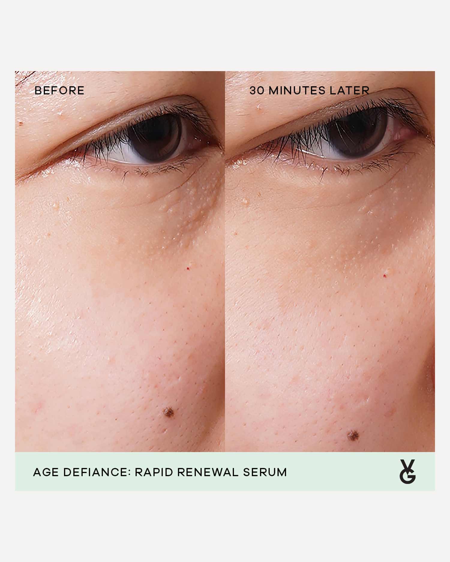 Age Defiance Rapid Renewal Serum